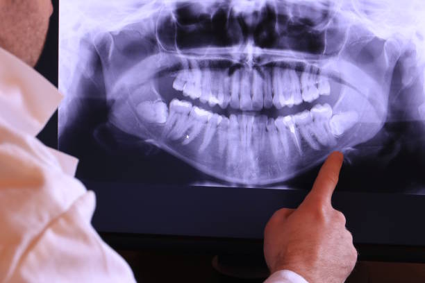 Best Emergency Broken Tooth Repair in Northfield, IL